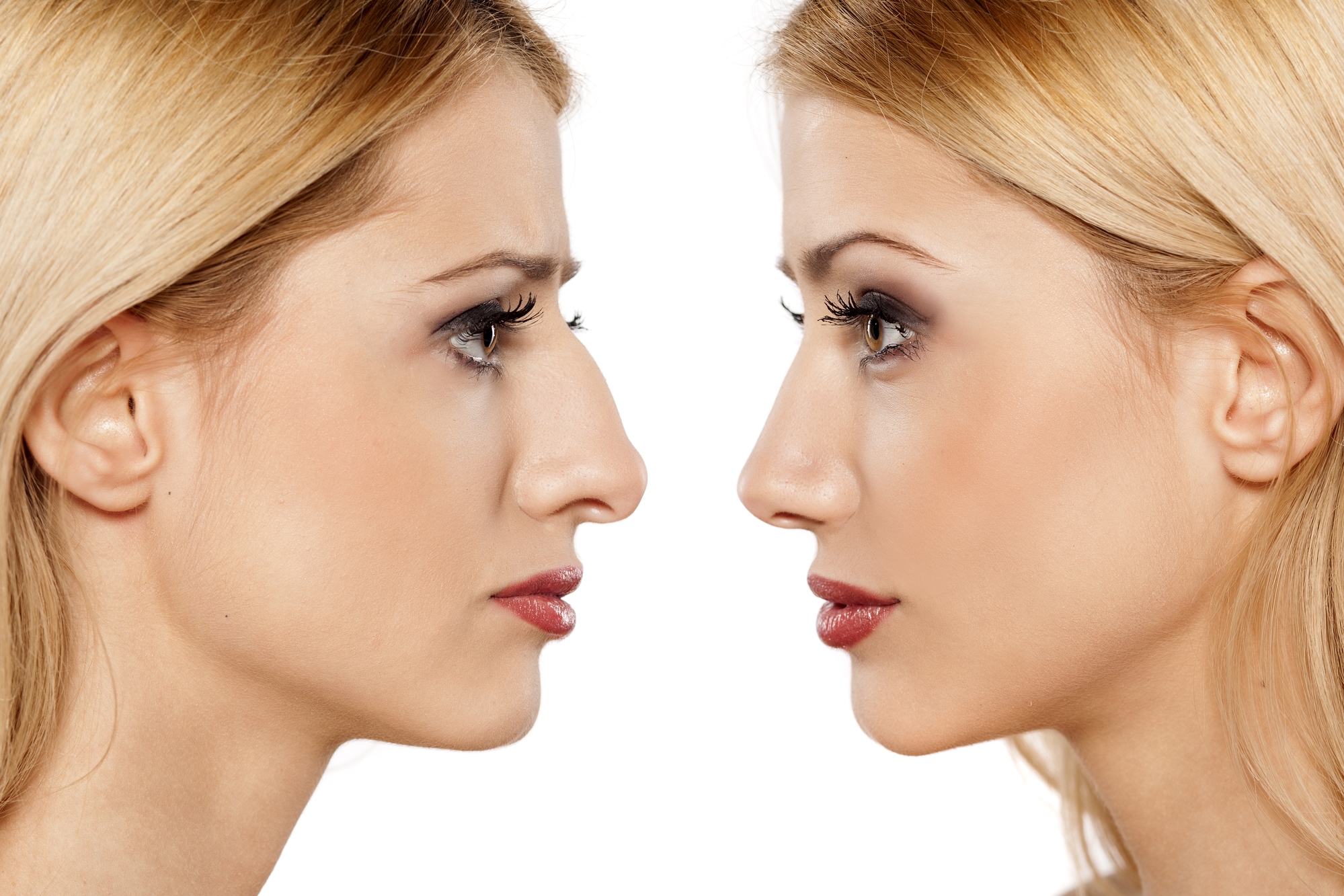 What is Rhinoplasty? Why it is done? - HealthPulls